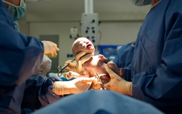 California campaign lowers statewide C-section rate, Stanford-led study finds
